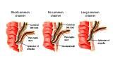 Anatomie: oesophagus (slokdarm), cardia (maag),duodenum,choledochus,galblaas,lever,pancreas,ileum,jejunum,colon,sigmoid,rectum,anusuterus,omentum,nier,vena porta,aorta.