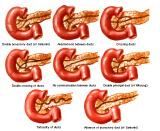 Anatomie: oesophagus (slokdarm), cardia (maag),duodenum,choledochus,galblaas,lever,pancreas,ileum,jejunum,colon,sigmoid,rectum,anusuterus,omentum,nier,vena porta,aorta.