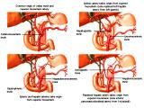 Anatomie: oesophagus (slokdarm), cardia (maag),duodenum,choledochus,galblaas,lever,pancreas,ileum,jejunum,colon,sigmoid,rectum,anusuterus,omentum,nier,vena porta,aorta.