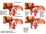 Anatomie: oesophagus (slokdarm), cardia (maag),duodenum,choledochus,galblaas,lever,pancreas,ileum,jejunum,colon,sigmoid,rectum,anusuterus,omentum,nier,vena porta,aorta.