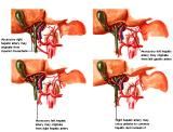 Anatomie: oesophagus (slokdarm), cardia (maag),duodenum,choledochus,galblaas,lever,pancreas,ileum,jejunum,colon,sigmoid,rectum,anusuterus,omentum,nier,vena porta,aorta.