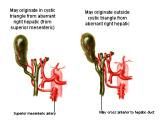 Anatomie: oesophagus (slokdarm), cardia (maag),duodenum,choledochus,galblaas,lever,pancreas,ileum,jejunum,colon,sigmoid,rectum,anusuterus,omentum,nier,vena porta,aorta.