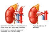 Anatomie: oesophagus (slokdarm), cardia (maag),duodenum,choledochus,galblaas,lever,pancreas,ileum,jejunum,colon,sigmoid,rectum,anusuterus,omentum,nier,vena porta,aorta.