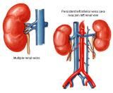 Anatomie: oesophagus (slokdarm), cardia (maag),duodenum,choledochus,galblaas,lever,pancreas,ileum,jejunum,colon,sigmoid,rectum,anusuterus,omentum,nier,vena porta,aorta.