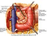 Anatomie: oesophagus (slokdarm), cardia (maag),duodenum,choledochus,galblaas,lever,pancreas,ileum,jejunum,colon,sigmoid,rectum,anusuterus,omentum,nier,vena porta,aorta.