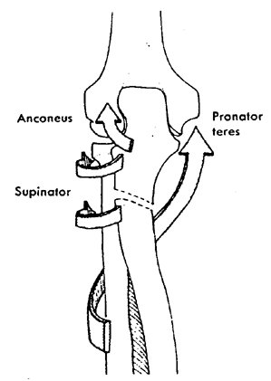 Monteggia fractuur