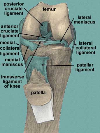 Collaterale bandletsel van mediale kniebanden